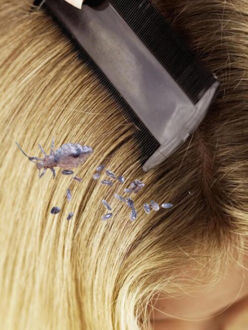 EBOOK• Naturalna ochrona włosów – zwalczaj wszy i zapobiegaj ich powrotom