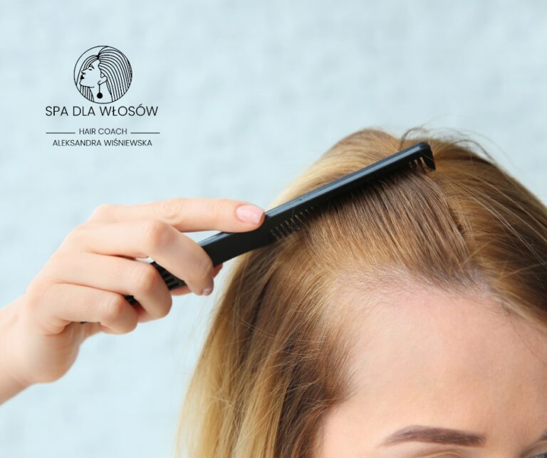 Łysienie androgenowe u kobiet