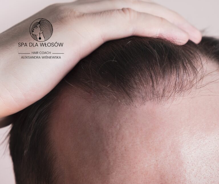 Niedobory witamin a wypadanie włosów