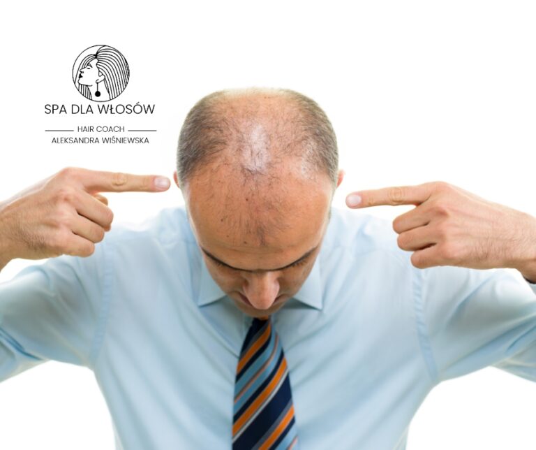 stres wpływa na wypadanie włosów