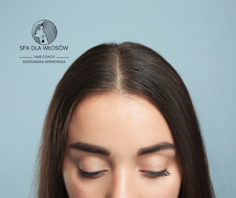 wypadanie włosów to objaw choroby